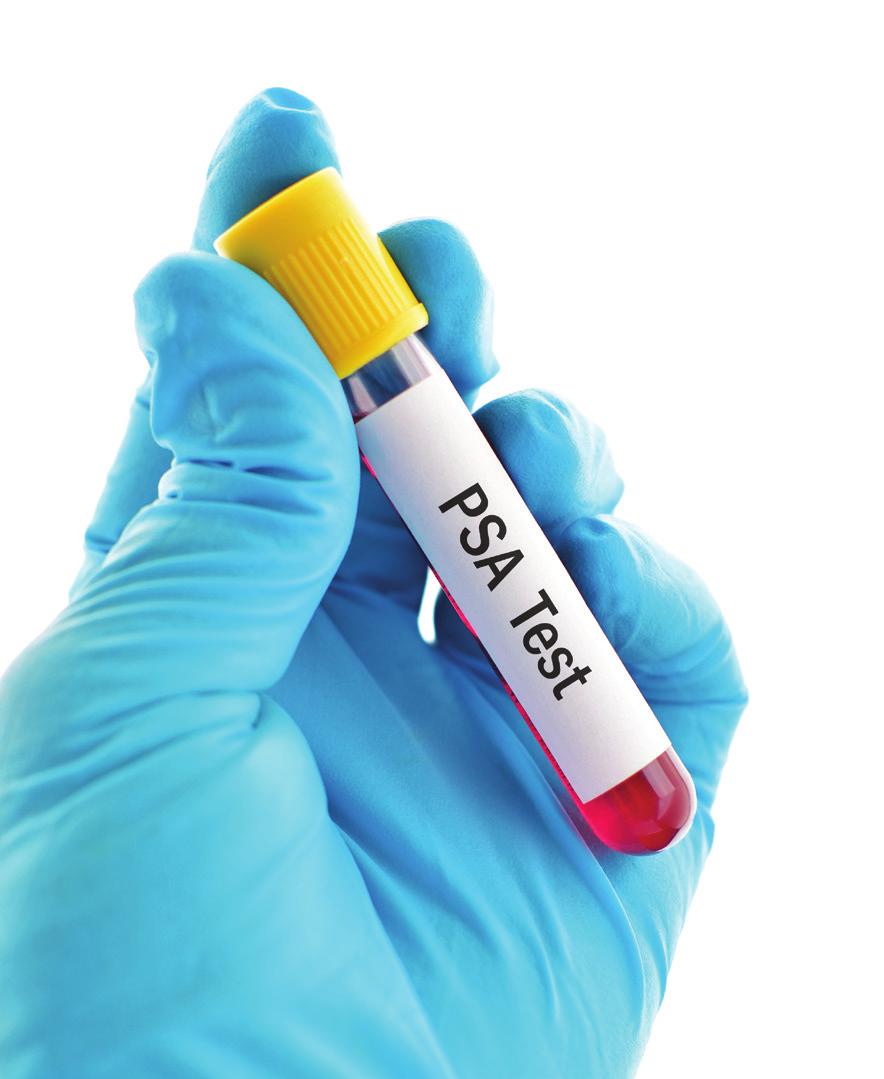 Should I get screened for prostate cancer? What you should know about the PSA test > What is PSA?