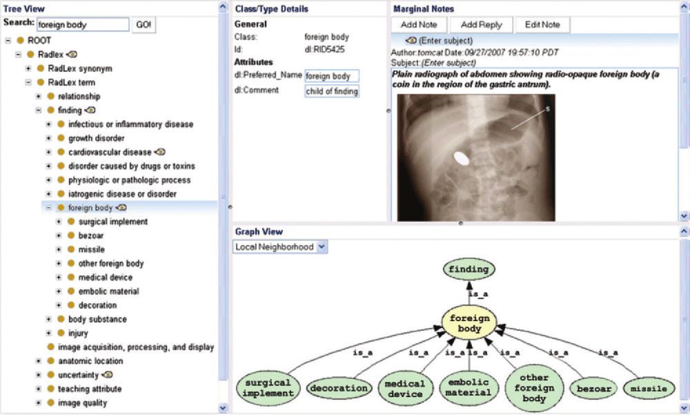 RG Volume 31 Number 6 Rubin 1521 Figure 6. RadLex, a controlled terminology for radiology, as visualized in a graphical terminology browser (BioPortal; http://bioportal.bioontology.org).