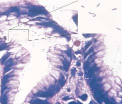 The bacteria are bacilliform and of uniform diameter (modified Giemsa, original magnification, 96).