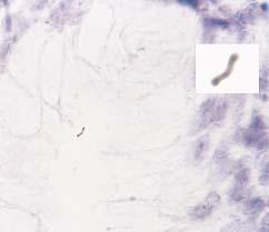 Image 6 Immunohistochemical stain, spiral Helicobacter pylori with terminal knobs, producing a barbell shape (diaminobenzidine counterstain, 192 with oil immersion lens).