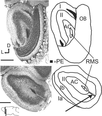 2 Anterior Olfactory Nucleus (Fig.