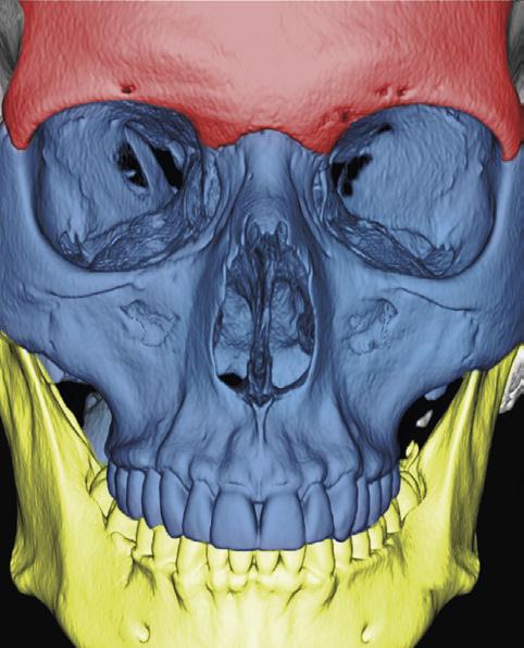Furlow CE the nostrils and the upper teeth and extend upward between the nose and the lower and inner edges of the orbits. Figure 3.