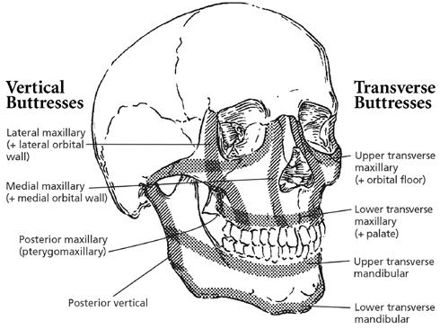 This system is used by otolarynglogists to describe locations of fractures in the facial skeletal anatomy. Reprinted with permission from Winegar BA, Murillo H, Tantiwongkosi B.