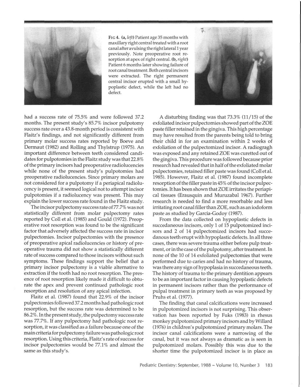 FIG 4. (a, left) Patient age 35 months with maxillary right central treated with a root canal after avulsing the right lateral 1 year previously.