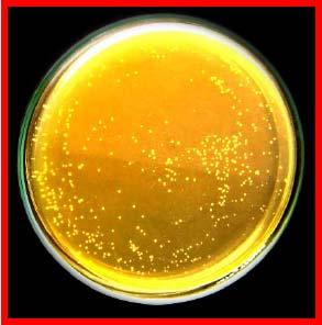 FIGURE 1. Colony of Lactobacillus acidophilus on Man Rogosa Sharpe agar All leading conventional, herbal tooth paste and tooth powder brands were purchased from local market.