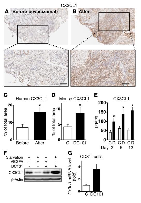 The Journal of Clinical Investigation Figure 3. Blockade of VEGF/VEGFR2 signaling upregulates CX3CL1 in both human and mouse CRCs.