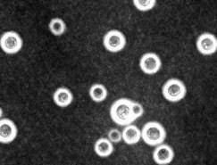 International Journal of Scientific and Research Publications, Volume 3, Issue 3, March 2013 3 Figure 2: India ink preparation demonstrating the negative staining of Cryptococci. (India ink; x200) V.