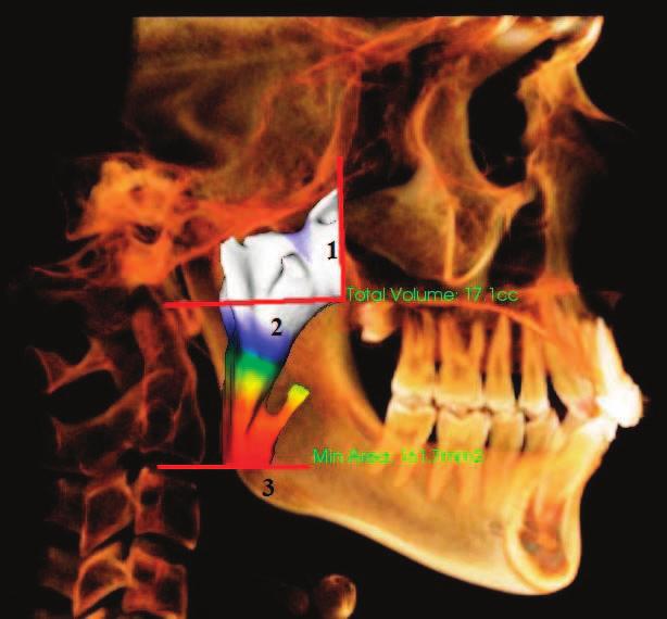 Thus, the use of CBCT has many advantages over conventional radiographic technique and other 3D imaging techniques such as CT scans.