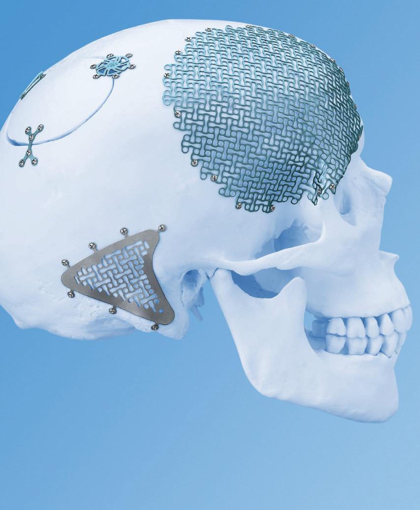 MatrixNEURO. The next generation cranial plating system.