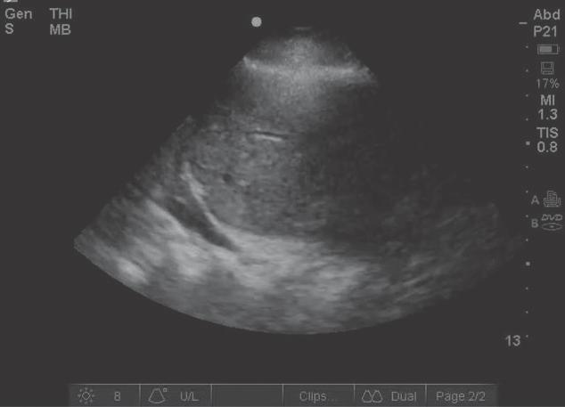 Thoracic ultrasonography requires specific training in image acquisition, image interpretation, and in the cognitive elements of the field. Figure 13.