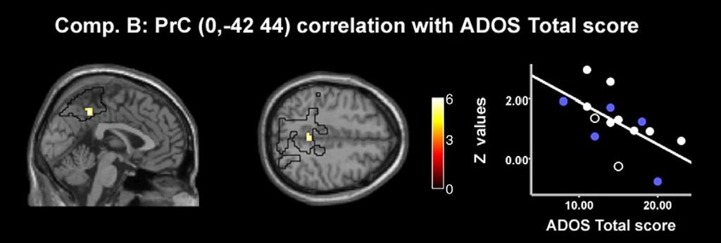 Abnormal Functional Connectivity in Autism Spectrum Disorder Patients Precuneus: Correlation with ADOS Total score Compared to controls, ASD patients showed decreased FC between areas of the DMN.