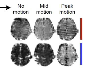 Resting-state FMRI confounds: Motion Movement of the head causes the content of each voxel to change, and this will determine