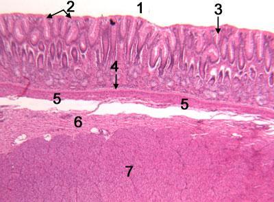 Pylorus of stomach: 1-1- Lumen. 2- Surface epithelium. 3- Pit.