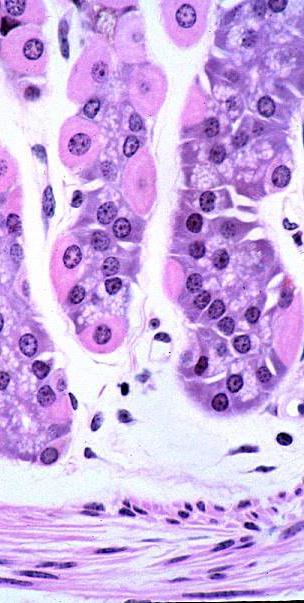 Appearance Acidophilic (pink). Basophilic (blue). Dark cells with red nuclei.