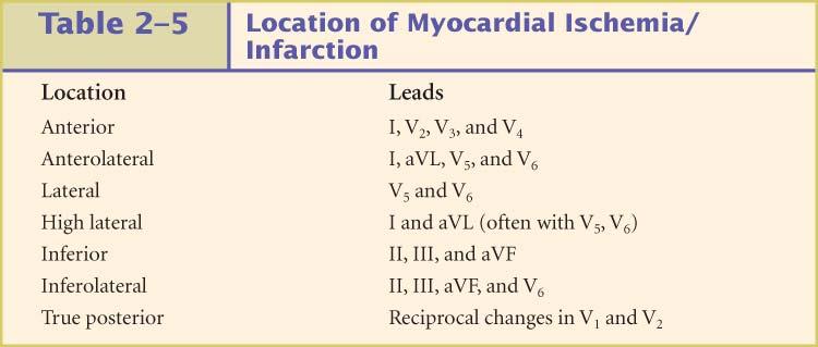 Localization of an AMI Reciprocal Changes II, III, avf I, avl, V-Leads ST elevation may show as ST Depression in reciprocal leads and vice versa Not necessary to presume infarction Strong confirming