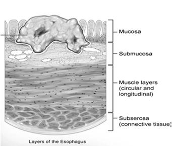 LAYERS OF THE ESOPHAGEAL WALL Mucosa Surface epithelium, lamina propria, and muscularis mucosa Submucosa Connective tissue, blood