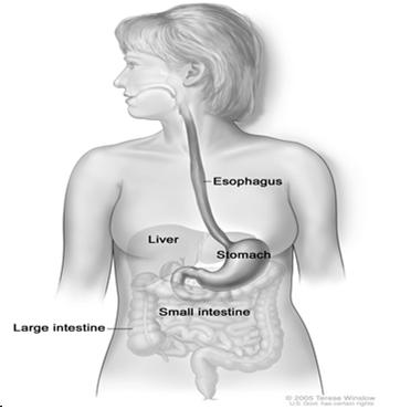 DISTANT METASTASIS: ESOPHAGUS The most common sites are: Liver Lungs Pleura DISTANT METASTASIS: STOMACH The most common sites are: Liver Peritoneal surface Distant lymph nodes GRADE For Esophagus and
