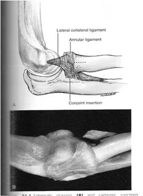 to ulna and annular ligament Maintains relationship of forearm to trochlea and capitellum Resists posterior lateral rotatory instability Annular Ligament