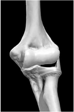 annular ligament for common insertion to ulna Lateral laxity allows prox FA to sublux away from humerus when loaded in supination.