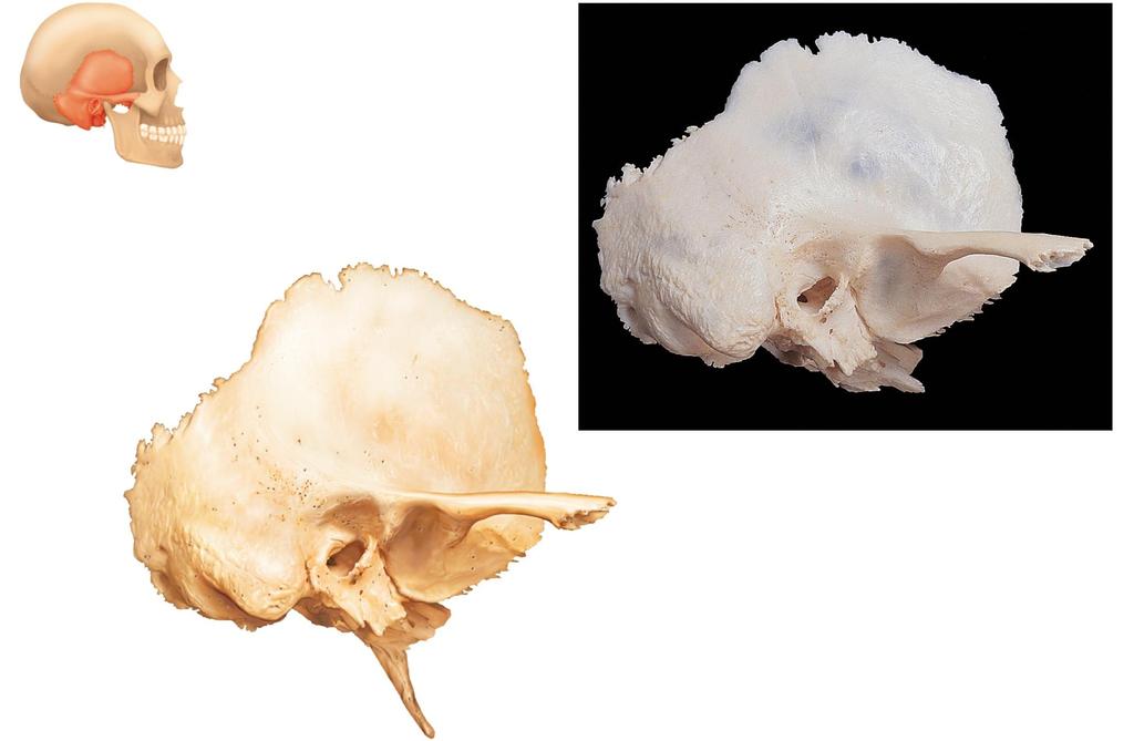 Figure 7.8 The temporal bone.