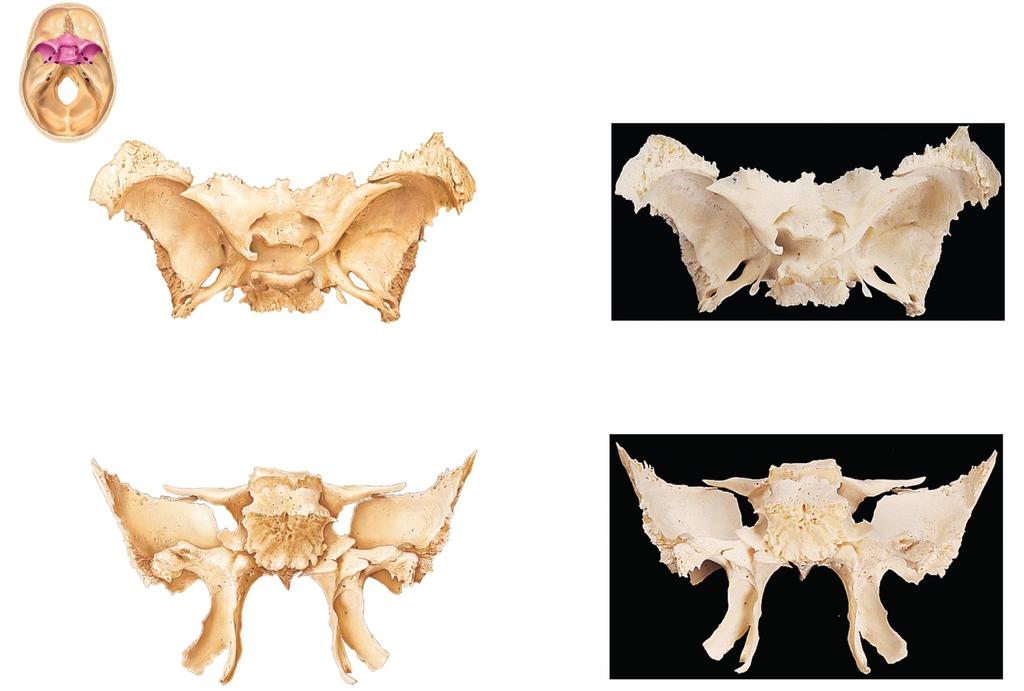 Figure 7.9 The sphenoid bone.