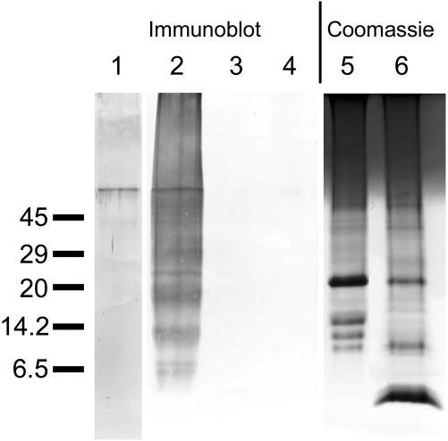 Several amyloid proteins were found after Coomassie blue staining, some of which had been identified by amino acid sequencing. 15 Similar to corneal amyloid (Fig.