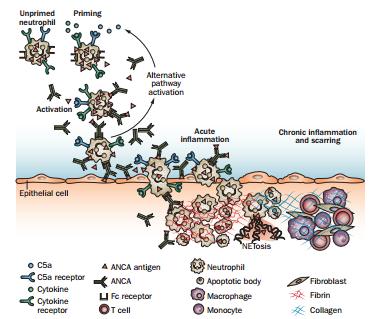 Pathogenesis of AAV Jennette, J. C. & Falk, R. J. Nat. Rev. Rheumatol.
