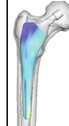 datasets L: A(L) Training data: L i 3D image of femur: I (i) Size: s (i) Position and orientation : T (i) Training