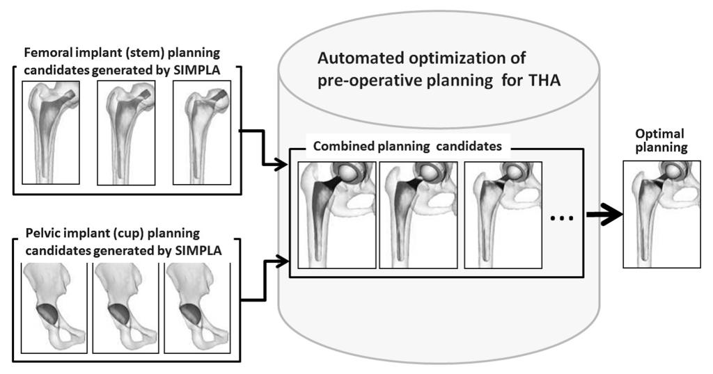 Figure 6.1: Overview of automated optimization of pre-operative planning. The author obtained optimal results in all cases with both AOCP-w/R and AOCP-w/oR.
