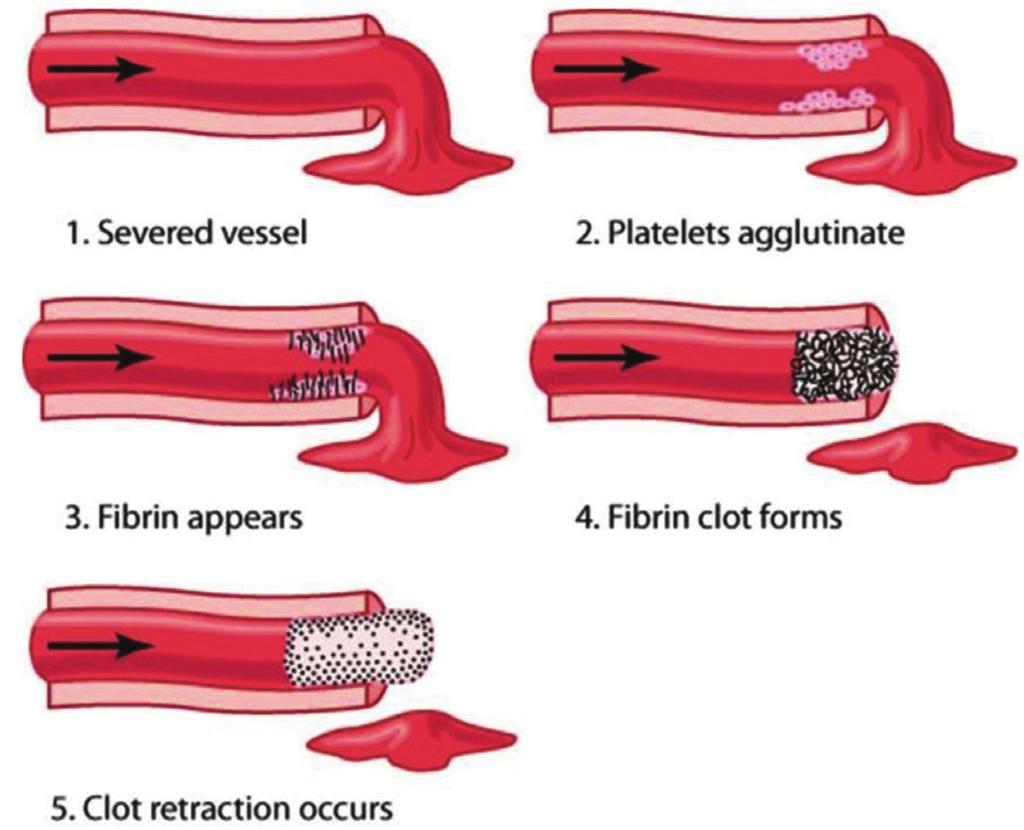 ABDUL MAJEED, RAHUL RAJEEV REVIEW ARTICLE INTRODUCTION Hemostasis is the process of forming clots in the walls of damaged blood vessels and preventing blood loss while maintaining blood in a fluid