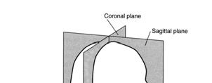 The source should be coincident with the midsagittal plane of the head at the level of the bridge of the nose.