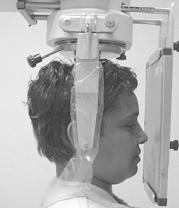 development PA Ceph Projection The image receptor is placed in front of the patient, perpendicular to the midsagittal