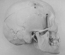 Lateral Skull Landmarks Lateral Cephalometric Projection
