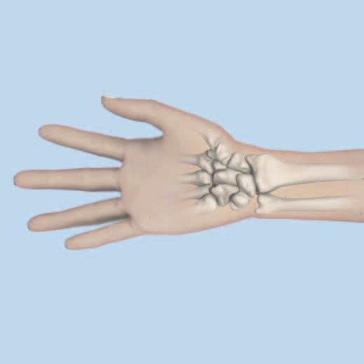 Approach Make a longitudinal incision slightly radial to the flexor carpi radialis tendon (FCR). Dissect between the FCR and the radial artery, exposing the pronator quadratus.
