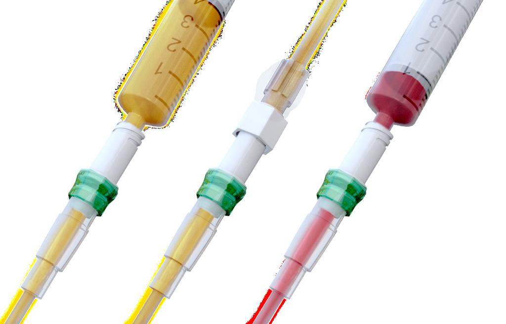 What is bionector? bionector is a Neutral Displacement Needleless Connector for use with all I.V. equipment (e.g.