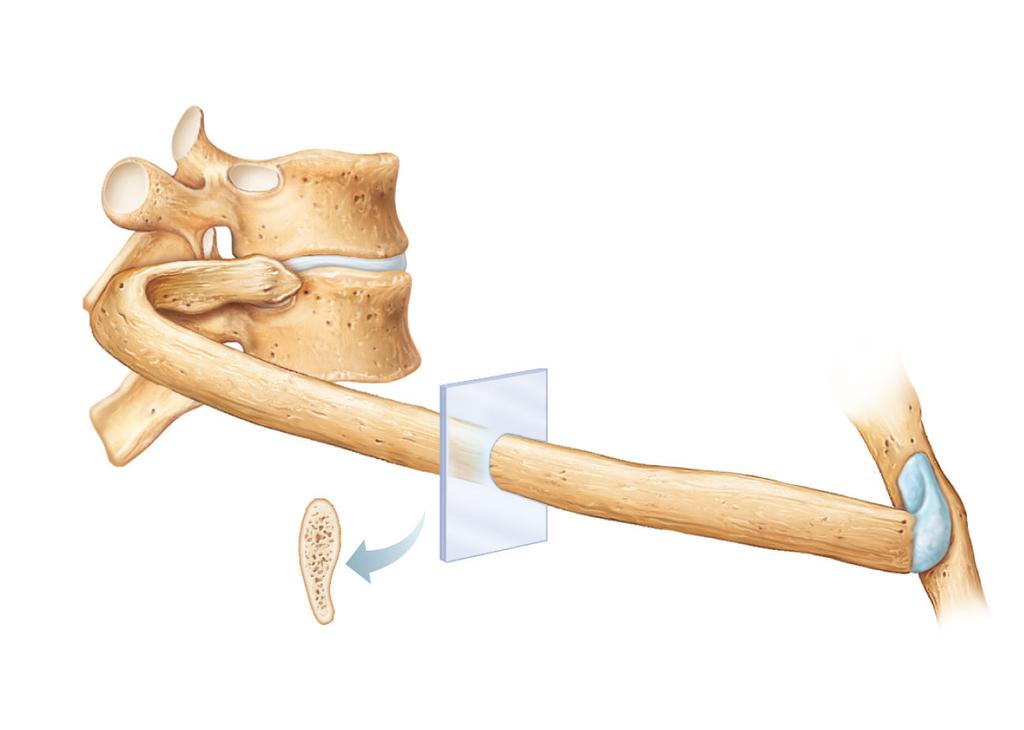 22a Structure of a Typical Rib Main parts: Head Articulates posteriorly with s (demis) on bodies of two adjacent vertebrae Neck Tubercle Articulates posteriorly