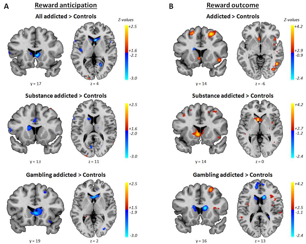 efigure 6. Stability of whole-brain meta-analytic results after excluding studies with partial brain coverage (n = 5).