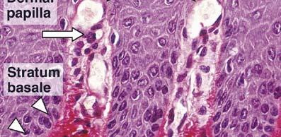 eosinophilic epidermal cells.