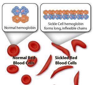 MUTATIONS CAN CHANGE PROTEIN SHAPE Since shape is determined by amino acid sequence; changing sequence changes 3D shape EX: Sickle cell anemia