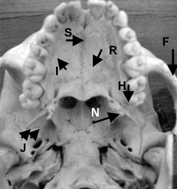 Fig.1 Skull - lateral view Fig. 2 Skull - bottom view Fig. 3, 4. Periapical radiographs - maxillary premolar area Fig.