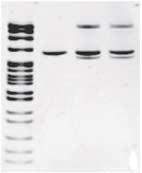 he three remaining samples displayed similar partial losses of chromosome 10q.