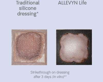 The masking layer minimizes the visual impact of strikethrough, 3 providing the patient with confidence that their dressing may not attract the negative attention of others.