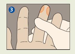 Skin Puncture for Collection of Capillary Blood Specimens Method: Finger Puncture Note: This method is appropriate for pediatric patients who are not walking and for adults.