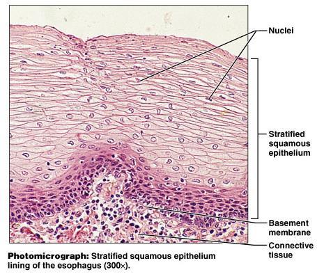 Stratified Squamous Epithelium Specific types Keratinized contain the protective protein