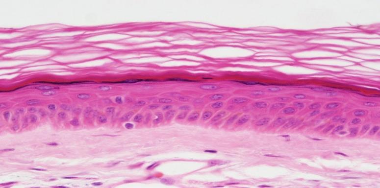 body openings Function Protects underlying tissues in areas subject to abrasion Location