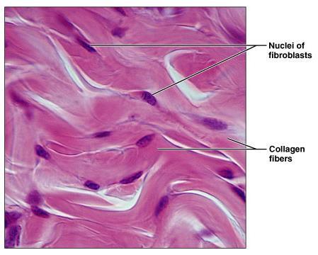 Dense Irregular Connective Tissue Description Primarily irregularly arranged collagen fibers Some
