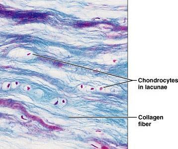 Fibrocartilage Description Matrix similar, but less firm than hyaline cartilage Thick collagen fibers predominate Function