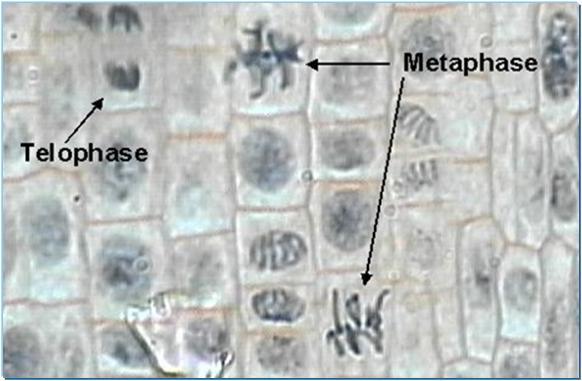 com/post/2746940737 7/fyeahuniverse-kidneycell-in-mitosis Kidney cell in metaphase) Spindle pole Metaphase