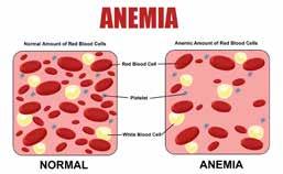 UNDERSTANDING ANEMIA OF CHRONIC KIDNEY DISEASE WHAT IS CHRONIC KIDNEY DISEASE (CKD)? When someone has CKD, it means that their kidney function has slowed down.