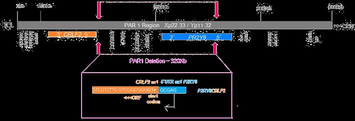 P2RY8-CRLF2 fusion